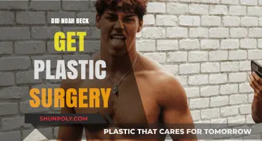 Noah Beck Plastic Surgery Rumors: Fact or Fiction?