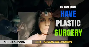 Noomi Rapace's Transformation: Plastic Surgery Rumors Explored