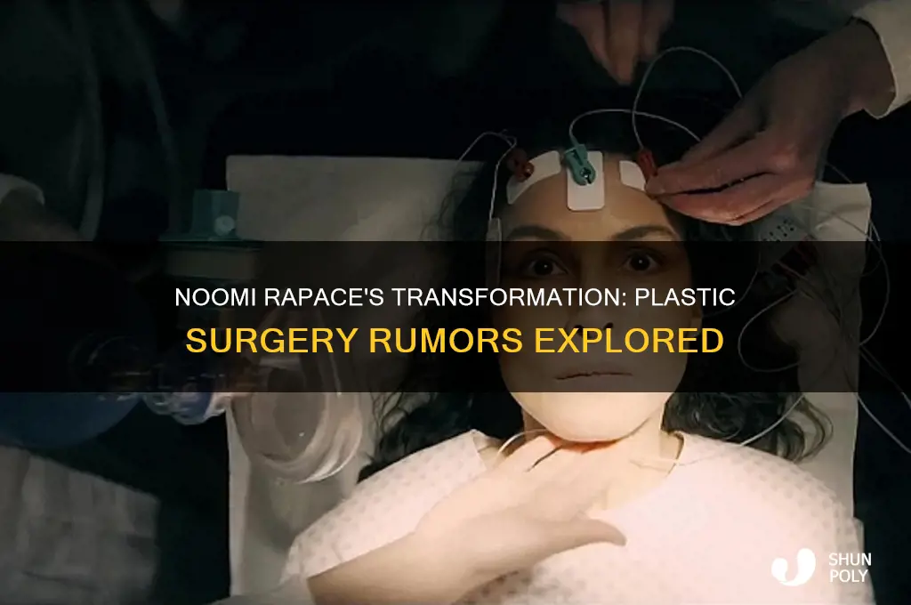 did noomi rapace have plastic surgery
