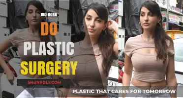 Did Nora Undergo Plastic Surgery? Unveiling the Truth Behind Her Look