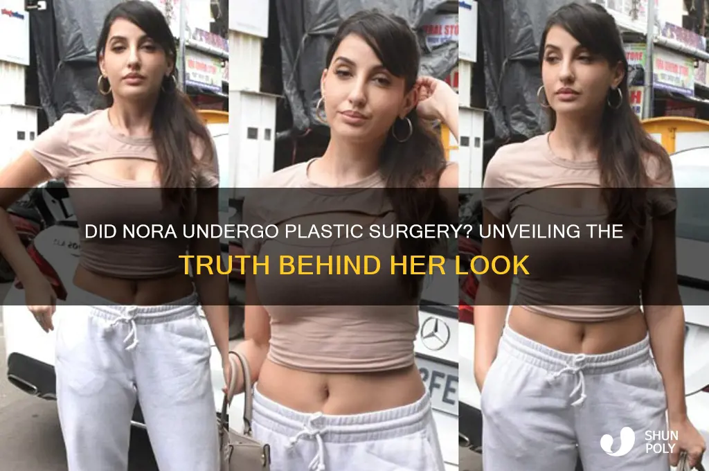 did nora do plastic surgery