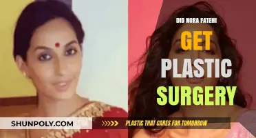 Nora Fatehi's Transformation: Plastic Surgery Rumors Explored and Debunked