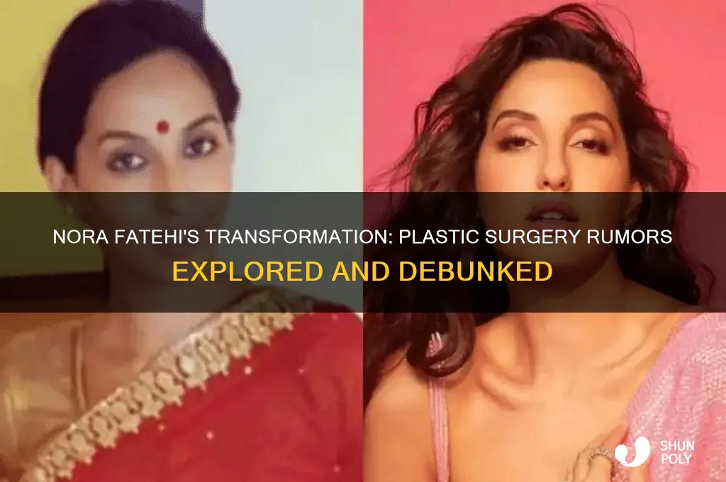 did nora fatehi get plastic surgery