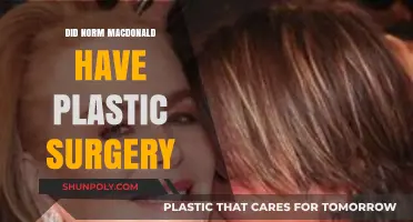 Norm Macdonald's Appearance: Plastic Surgery Rumors Explored and Debunked