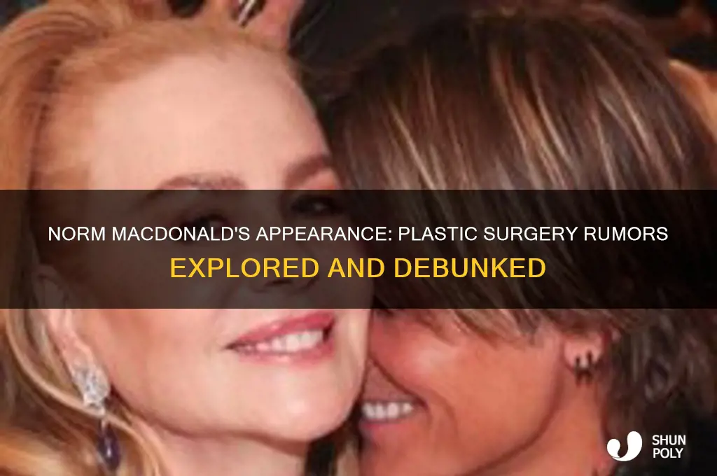 did norm macdonald have plastic surgery
