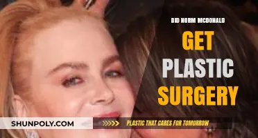 Norm Macdonald's Appearance: Plastic Surgery Speculations and Truths