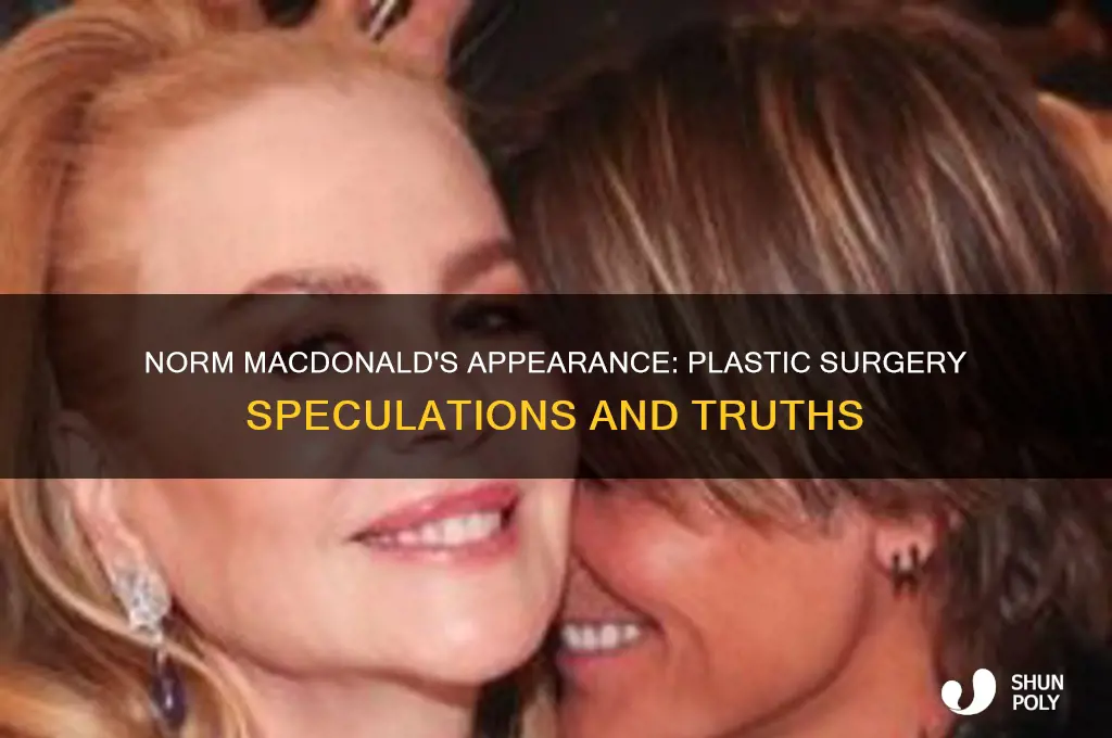 did norm mcdonald get plastic surgery