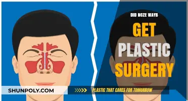 Did Noze Wayb Undergo Plastic Surgery? Unveiling the Truth