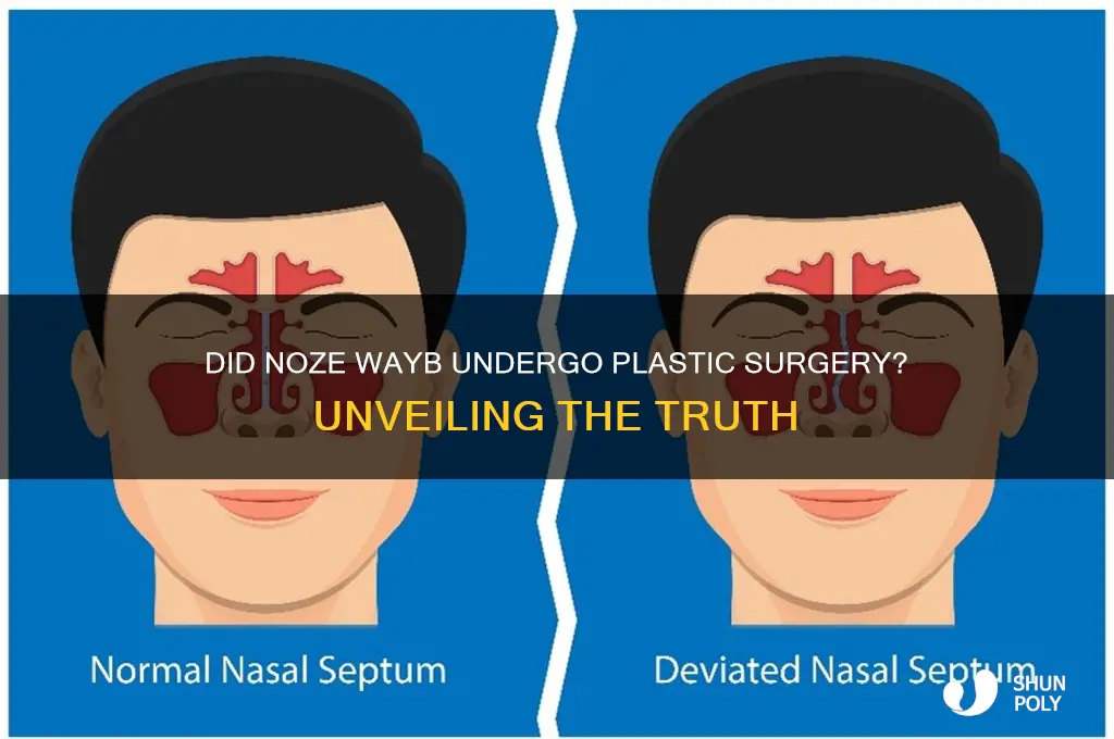 did noze wayb get plastic surgery