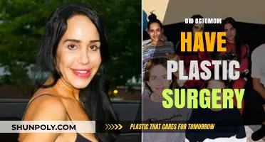 Octomom's Transformation: Unveiling the Truth About Her Plastic Surgery