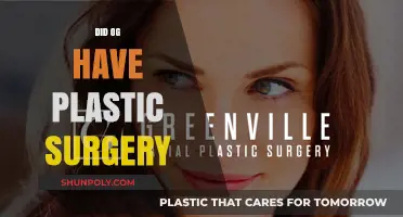 OG's Transformation: Unveiling the Truth About Plastic Surgery Speculations