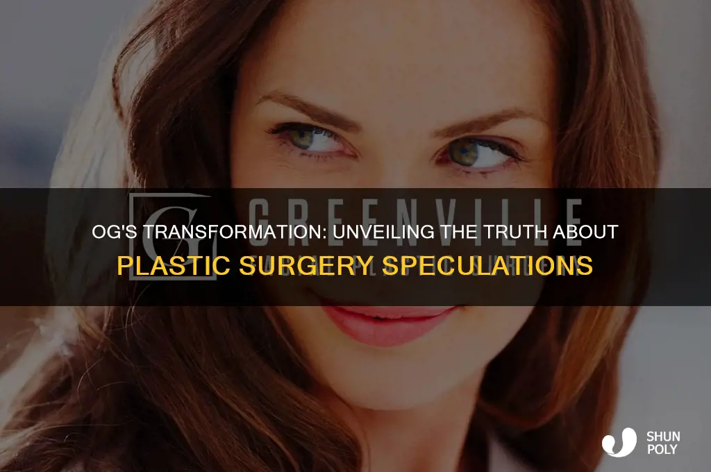 did og have plastic surgery