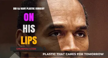 O.J. Simpson's Lip Transformation: Plastic Surgery Speculation Explored