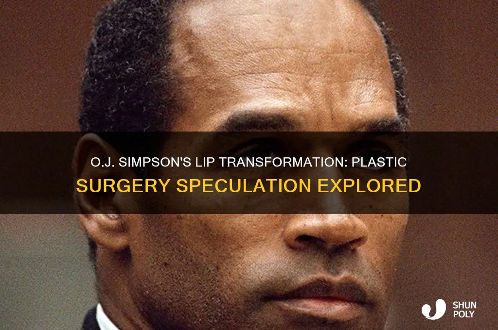 did oj have plastic surgery on his lips