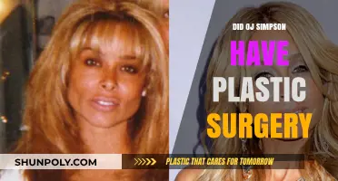 O.J. Simpson's Changing Appearance: Plastic Surgery Speculations Explored