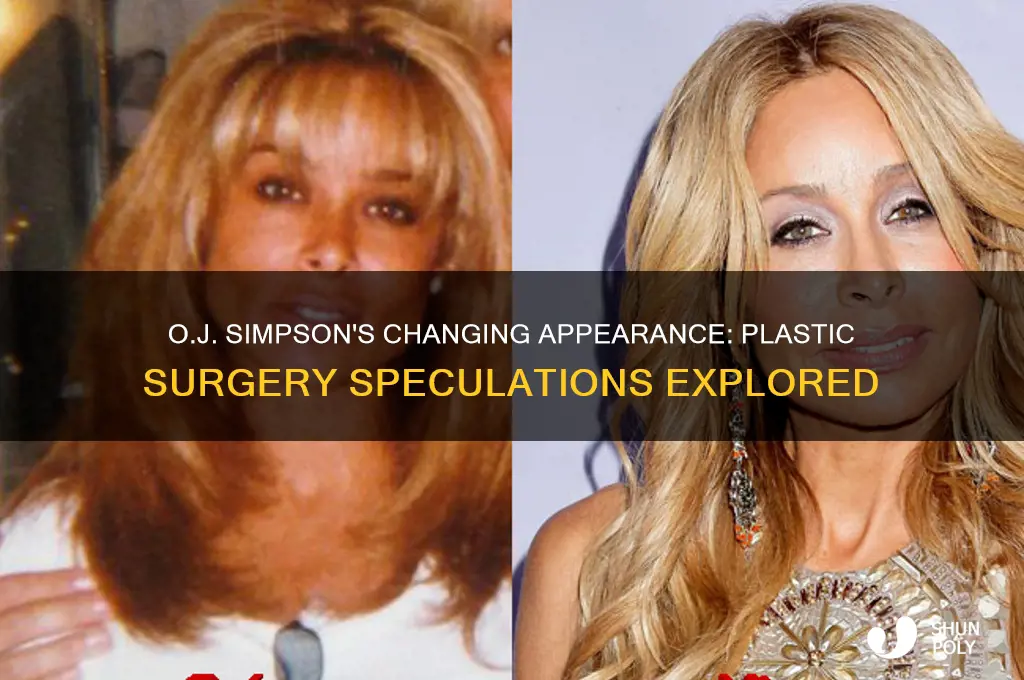 did oj simpson have plastic surgery
