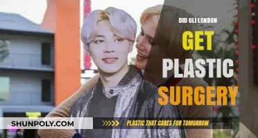 Oli London's Transformation: Plastic Surgery Speculations and Revelations