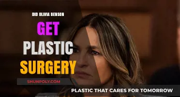 Olivia Benson's Transformation: Plastic Surgery Speculations and Truths