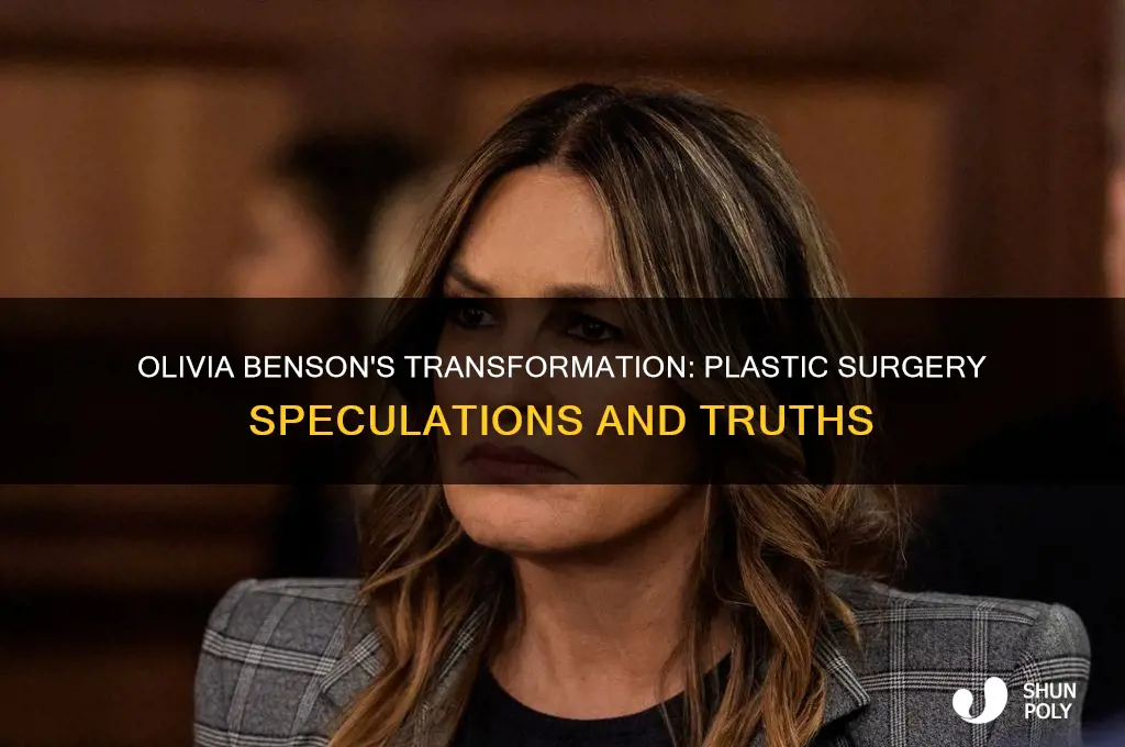 did olivia benson get plastic surgery