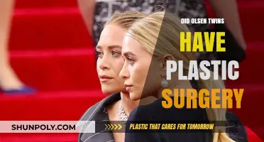 Olsen Twins Plastic Surgery: Fact or Fiction? Unveiling the Truth