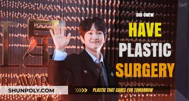 Onew's Transformation: Unveiling the Truth About Plastic Surgery Rumors