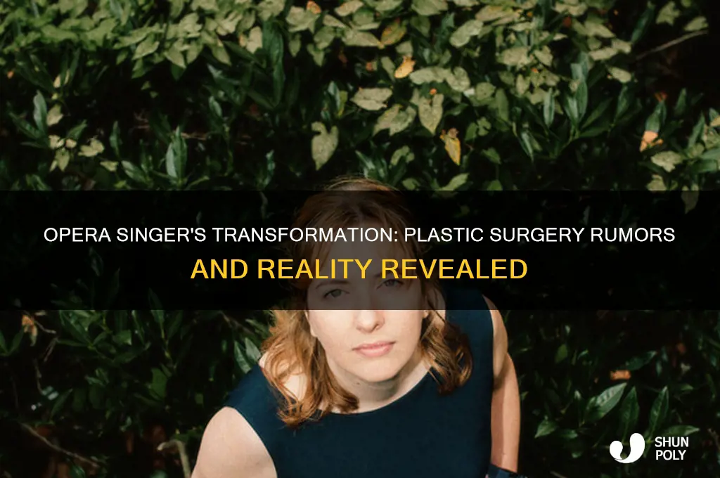 did opera have plastic surgery