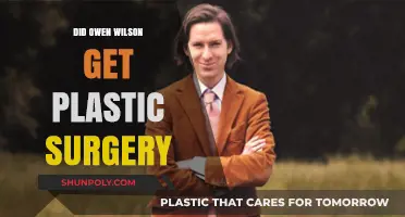 Owen Wilson's Transformation: Plastic Surgery Rumors Explored and Debunked
