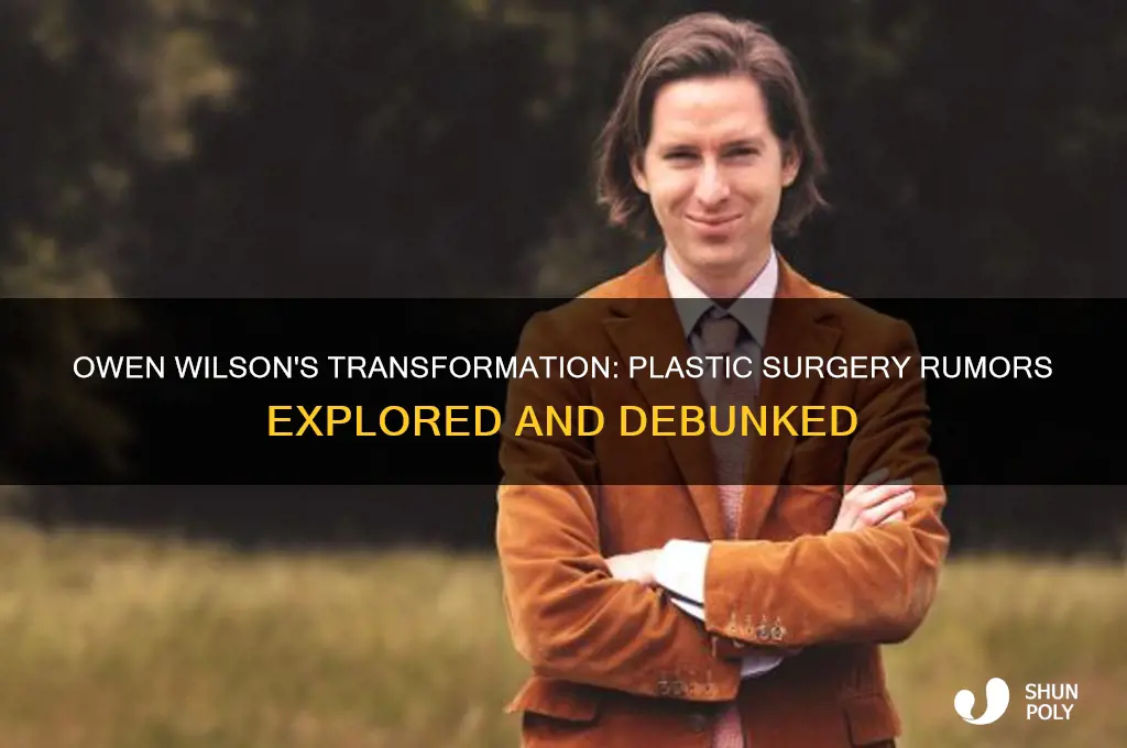 did owen wilson get plastic surgery