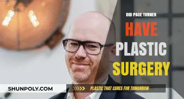 Did Page Turner Undergo Plastic Surgery? Uncovering the Truth