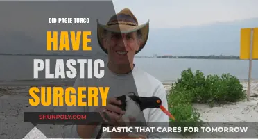 Pagie Turco Plastic Surgery: Fact-Checking the Rumors and Speculations