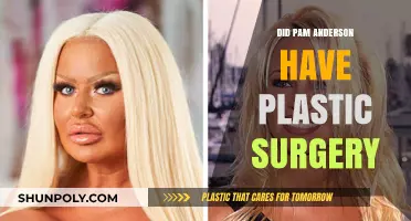 Pam Anderson's Transformation: Plastic Surgery Speculations and Truths Revealed