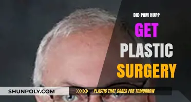 Did Pam Hupp Undergo Plastic Surgery? Unraveling the Truth