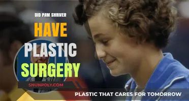 Pam Shriver Plastic Surgery: Fact-Checking the Rumors and Speculations