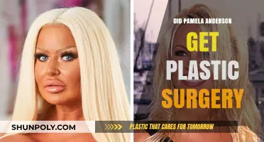 Pamela Anderson's Transformation: Plastic Surgery Rumors and Reality Revealed