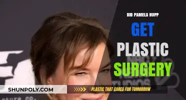 Pamela Hupp Plastic Surgery: Fact-Checking the Rumors and Speculations