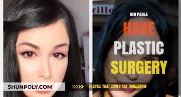 Did Paola Get Plastic Surgery? Uncovering the Truth Behind Her Look