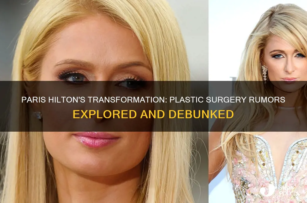did paris hilton get plastic surgery