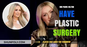 Paris Hilton's Transformation: Plastic Surgery Rumors and Reality Revealed