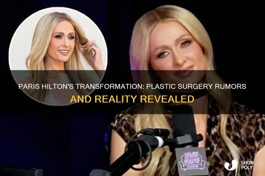 did paris hilton have plastic surgery