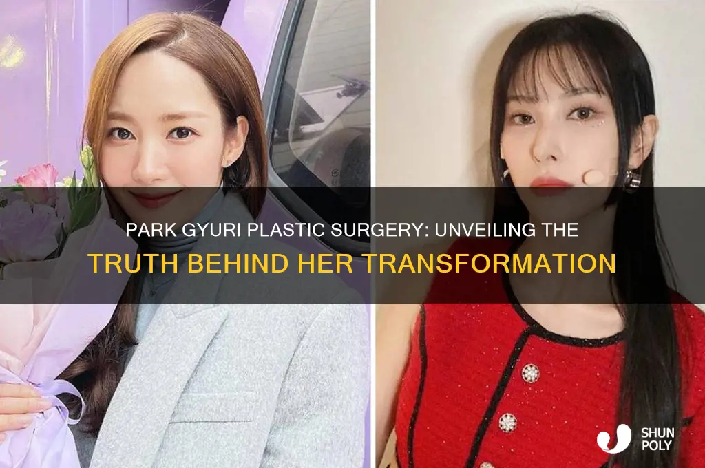 did park gyuri get plastic surgery