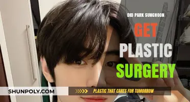 Park Sunghoon Plastic Surgery: Fact-Checking the Rumors and Speculations