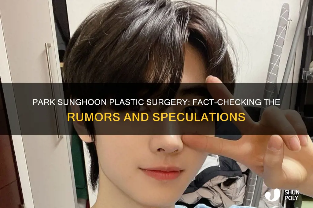 did park sunghoon get plastic surgery