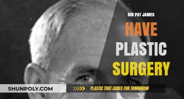 Pat James Plastic Surgery: Fact-Checking the Rumors and Speculations