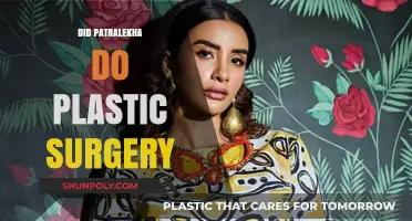Patralekha Plastic Surgery: Fact-Checking the Rumors and Speculations