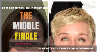Patricia Heaton's Transformation: Plastic Surgery Before 'The Middle' Finale?
