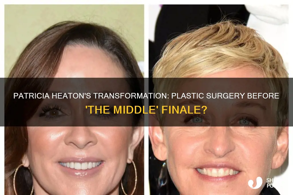did patricia heaton get plastic surgery before the middle finale
