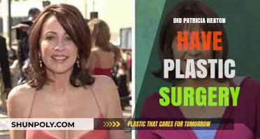 Patricia Heaton's Transformation: Plastic Surgery Speculations and Truths