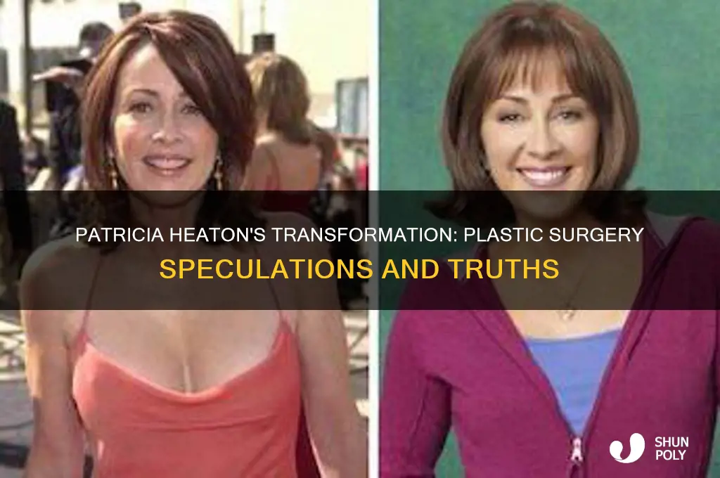 did patricia heaton have plastic surgery