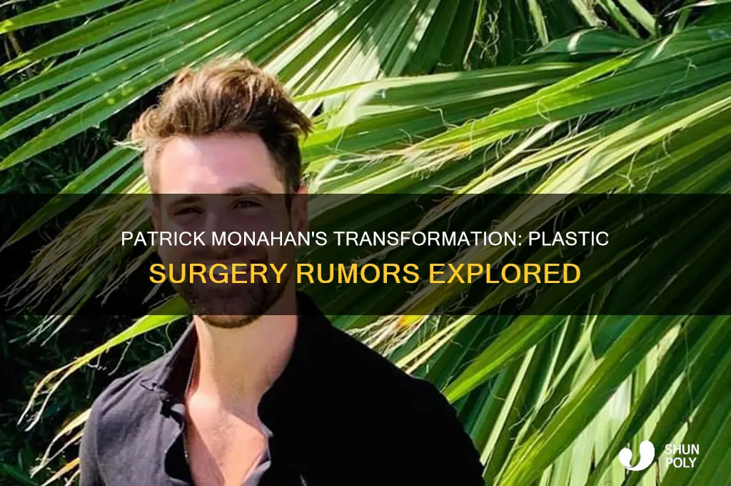 did patrick monahan have plastic surgery