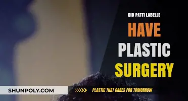 Patti LaBelle's Transformation: Plastic Surgery Rumors Explored and Debunked